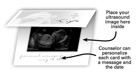 Ultrasound card outside and inside